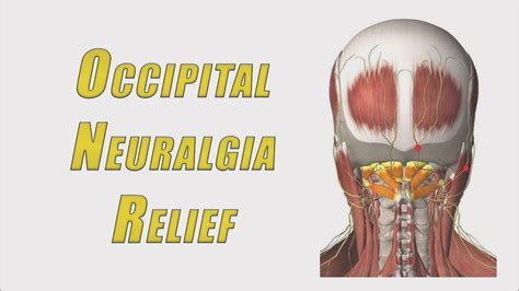 -Keeps your had in a safe position to prevent you from rolling into an unsuitable position when you sleep. . How i cured my occipital neuralgia